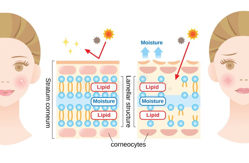 Stratum corneum, the most superficial layer of the epidermis, has a lamellar structure composed of layers of lipids and moisture. Stratum corneum, the most superficial layer of the epidermis, has a lamellar structure composed of layers of lipids and moisture