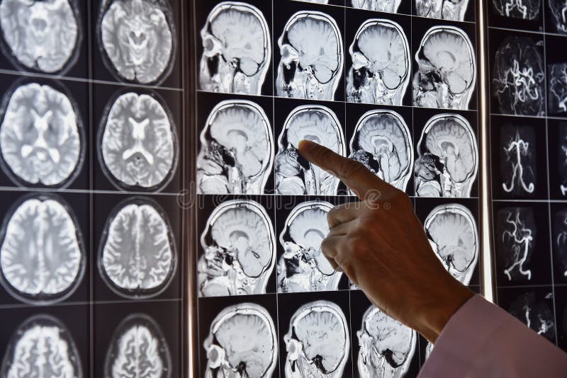 Доктор указывая изображение мозга MRI для того чтобы продемонстрировать анатомию в комнате радиологии стоковое изображение rf Доктор указывая изображение мозга MRI для того чтобы продемонстрировать анатомию в комнате радиологии стоковое изображение rf