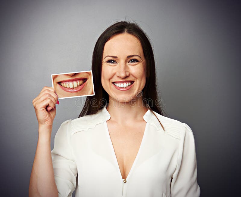 Smiley healthy woman holding picture with dirty yellow teeth. Smiley healthy woman holding picture with dirty yellow teeth