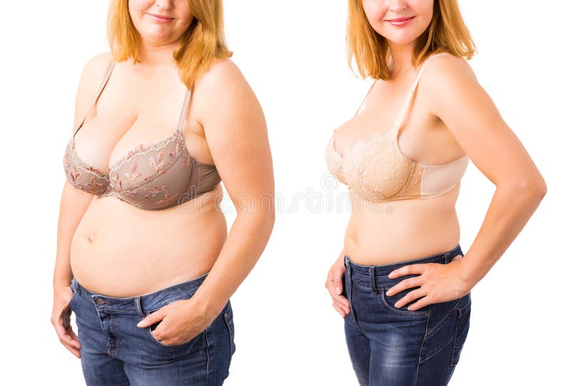 Женщина перед и после потерей веса