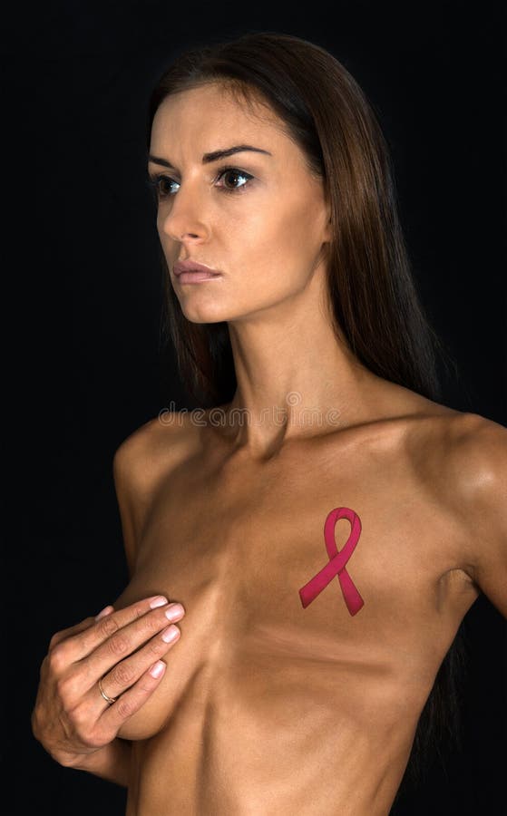 A female woman with breast cancer has had a mastectomy medical procedure. The lady is a survivor and has an awareness ribbon tattoo in place of the missing breast. Breast cancer is a serious healthcare issue for women. A female woman with breast cancer has had a mastectomy medical procedure. The lady is a survivor and has an awareness ribbon tattoo in place of the missing breast. Breast cancer is a serious healthcare issue for women.