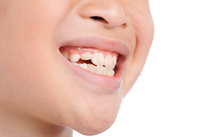 Close up thin focus on Boy smile show teeth on white background. Close up thin focus on Boy smile show teeth on white background