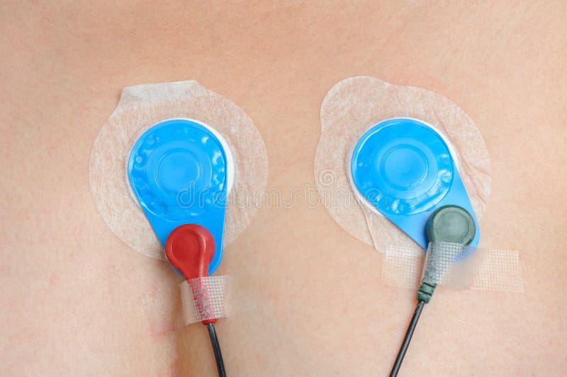 Кардиомонитор Holter стоковые фотографии rf Кардиомонитор Holter стоковые фотографии rf