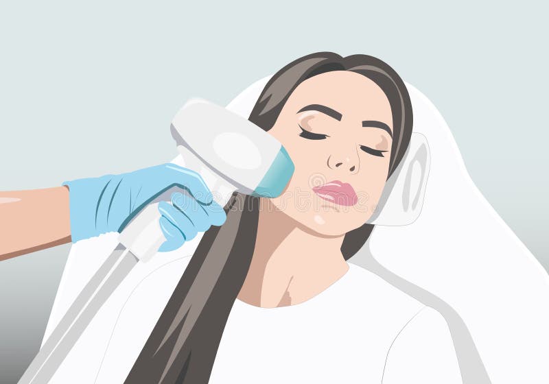 Illustration. Epilation Hair Removal Procedure on a Woman’s Face Stock