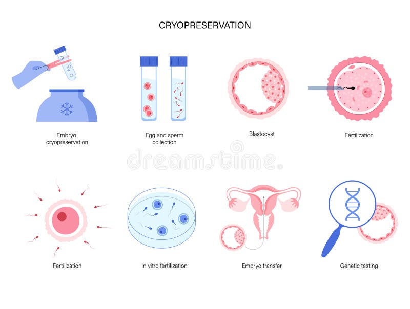 En que consiste la inseminacion in vitro
