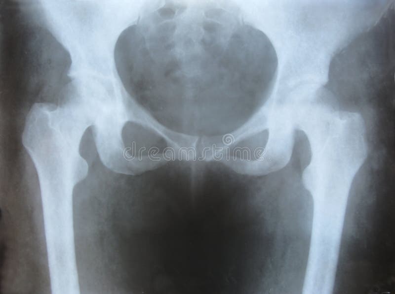 Medical copy of a feet and pelvic bones. Medical copy of a feet and pelvic bones