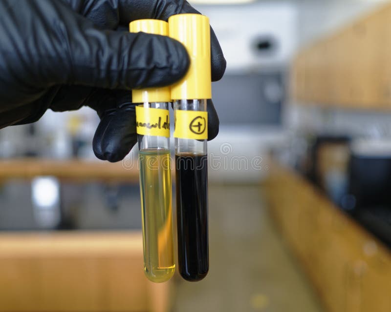 Food safety pathogen Listeria monocytogenes in Fraser broth, from a food sample. The positive tube is black. Food safety pathogen Listeria monocytogenes in Fraser broth, from a food sample. The positive tube is black