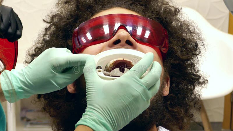 Отснятый видеоматериал персоны будучи подготавливанным для зубов забеливая на дантисте, дантист кладет его упорка рта