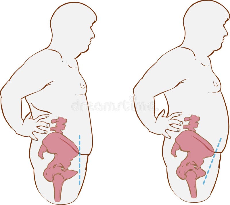 A vector illustration of Forward Hip Tilt. A vector illustration of Forward Hip Tilt