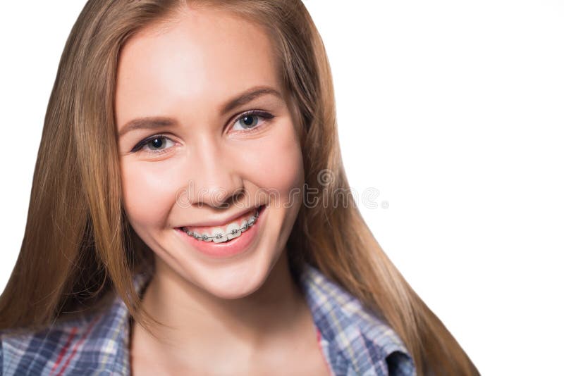 Beautiful young blondie girl showing her dental braces isolated on white. Beautiful young blondie girl showing her dental braces isolated on white