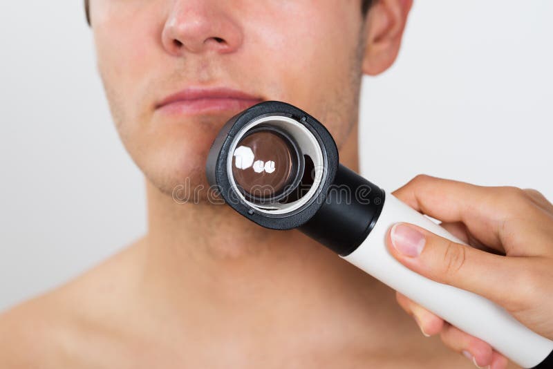 Руки персоны проверяя сторону человека с Dermatoscope стоковые изображения rf Руки персоны проверяя сторону человека с Dermatoscope стоковые изображения rf