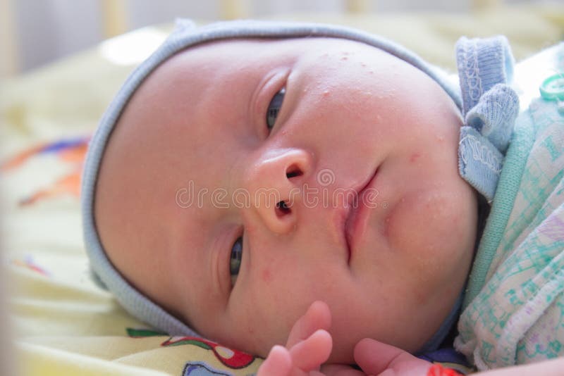 Сонный младенец лежит, newborn младенец с угорь на стороне стоковое фото rf Сонный младенец лежит, newborn младенец с угорь на стороне стоковое фото rf