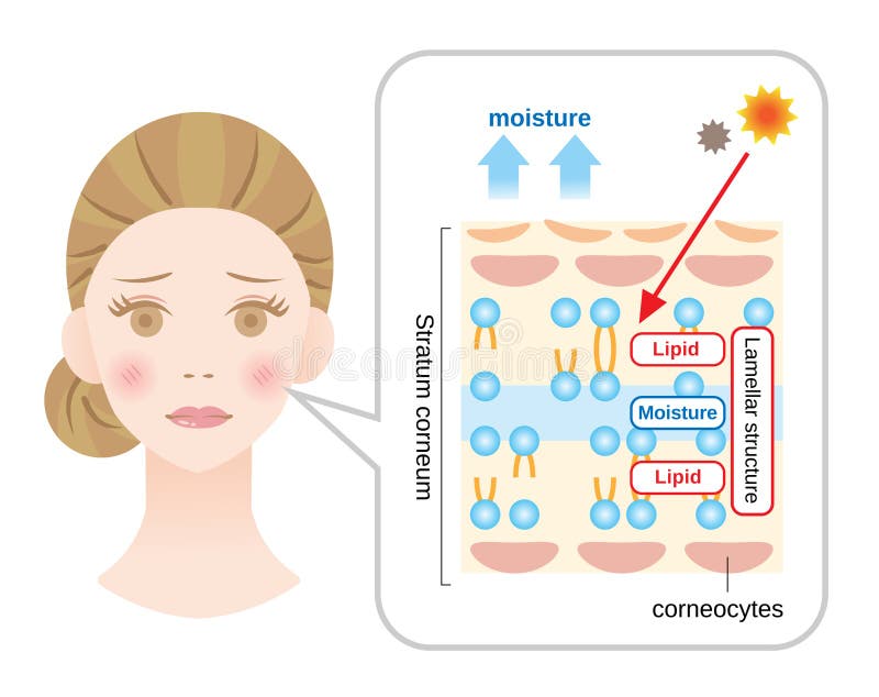 Stratum corneum, the most superficial layer of the epidermis, has a lamellar structure composed of layers of lipids and moisture. Stratum corneum, the most superficial layer of the epidermis, has a lamellar structure composed of layers of lipids and moisture