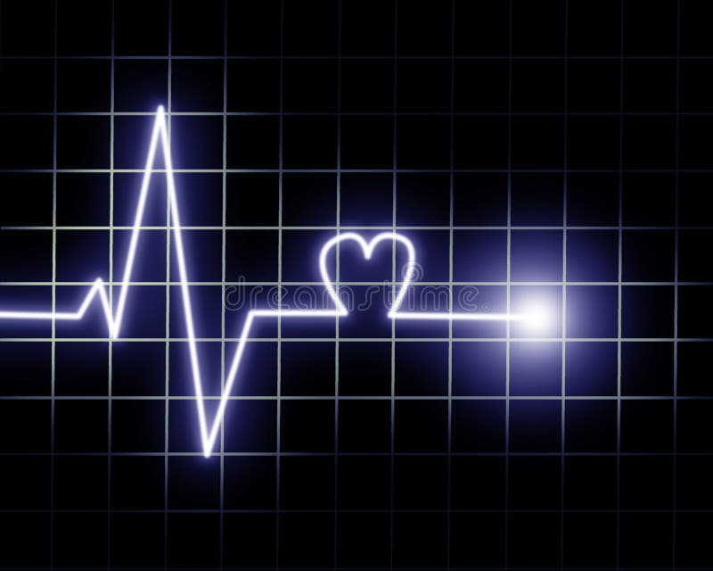 Heart beat as recorded on monitor. Heart beat as recorded on monitor