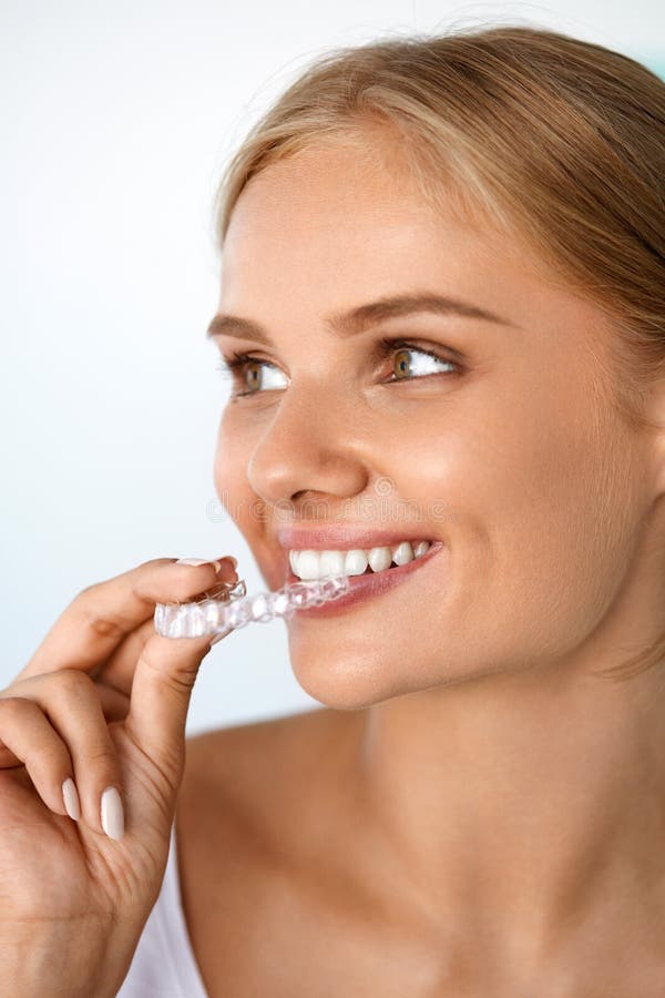 Orthodontics. Closeup Of Beautiful Happy Smiling Woman With White Smile, Straight Teeth Holding Whitening Tray, Invisible Braces, Teeth Trainer. Dental Treatment, Health Concept. High Resolution Image. Orthodontics. Closeup Of Beautiful Happy Smiling Woman With White Smile, Straight Teeth Holding Whitening Tray, Invisible Braces, Teeth Trainer. Dental Treatment, Health Concept. High Resolution Image