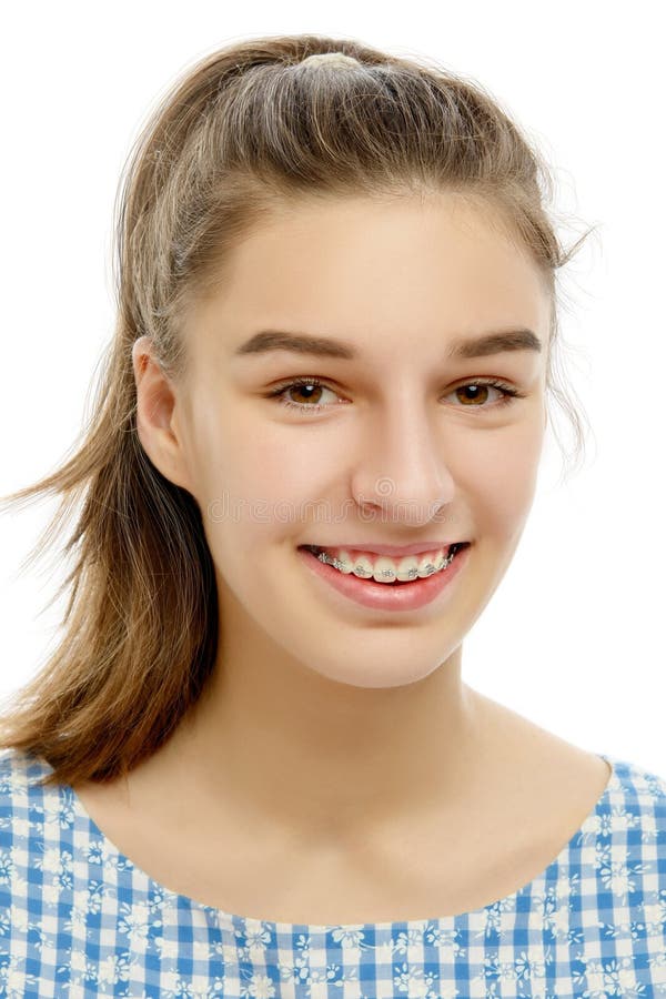 Portrait of Caucasian teenage girl with broad smile showing dental braces.Isolated on white background. Portrait of Caucasian teenage girl with broad smile showing dental braces.Isolated on white background.