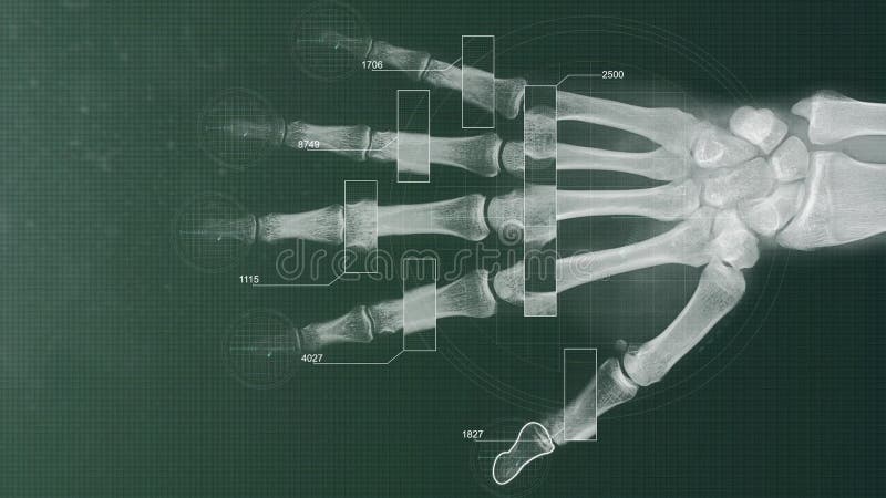 Футуристические скеннирование и анализировать рентгеновского снимка руки