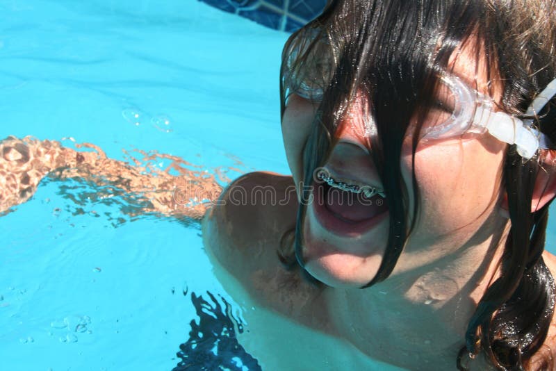 Boy with braces laughing in a pool. Boy with braces laughing in a pool.