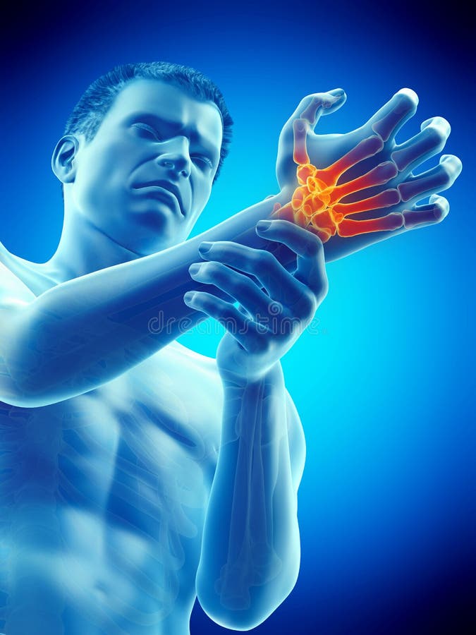 3d rendered medically accurate illustration of a man having a painful wrist. 3d rendered medically accurate illustration of a man having a painful wrist