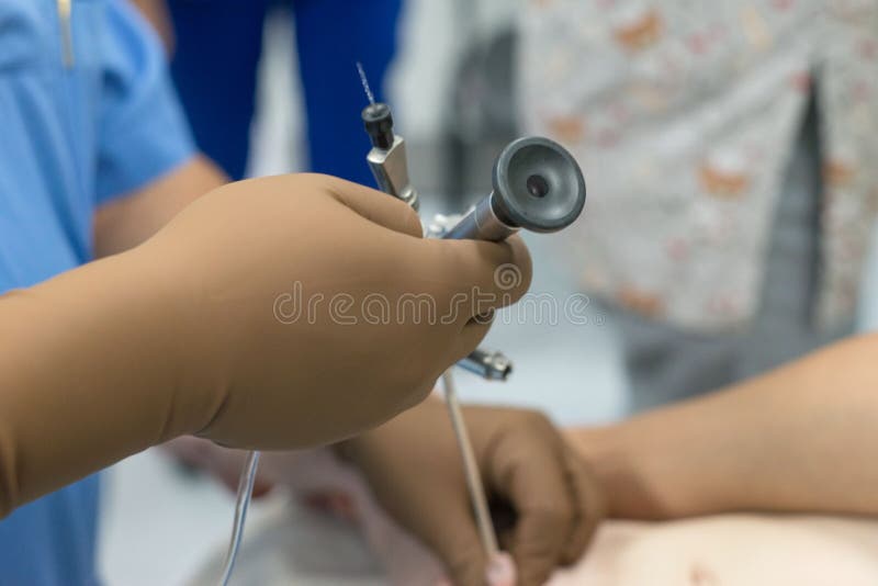 一组泌尿科医生用膀胱镜进行膀胱镜检查 在无菌手术室 关闭 图库摄影