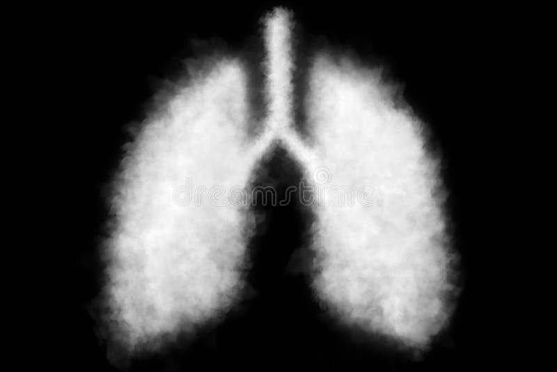 肺部有毒烟雾的插图 免版税图库摄影