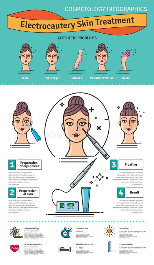 Vector Illustrated set with salon cosmetology electrocautery skin treatment. Infographics with icons of medical cosmetic procedures for skin. Vector Illustrated set with salon cosmetology electrocautery skin treatment. Infographics with icons of medical cosmetic procedures for skin.