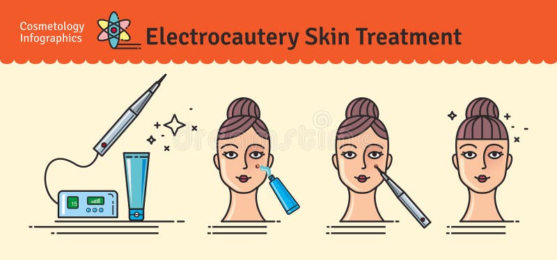 Vector Illustrated set with salon cosmetology electrocautery skin treatment. Infographics with icons of medical cosmetic procedures for skin. Vector Illustrated set with salon cosmetology electrocautery skin treatment. Infographics with icons of medical cosmetic procedures for skin.