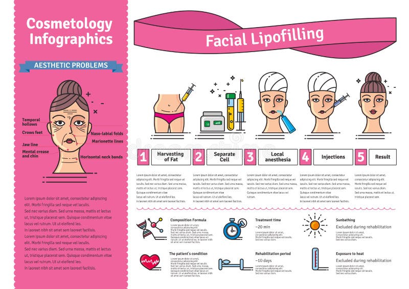 Vector Illustrated set with cosmetology facial lipofilling. Infographics with icons of medical cosmetic procedures. Vector Illustrated set with cosmetology facial lipofilling. Infographics with icons of medical cosmetic procedures.