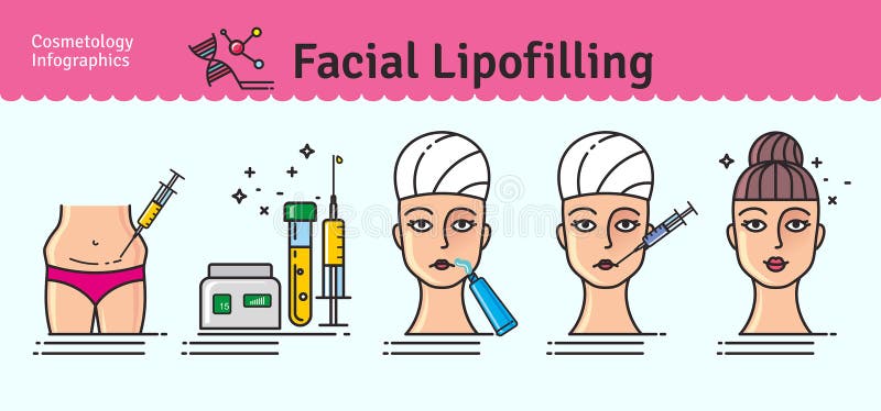 Vector Illustrated set with cosmetology facial lipofilling. Infographics with icons of medical cosmetic procedures. Vector Illustrated set with cosmetology facial lipofilling. Infographics with icons of medical cosmetic procedures.