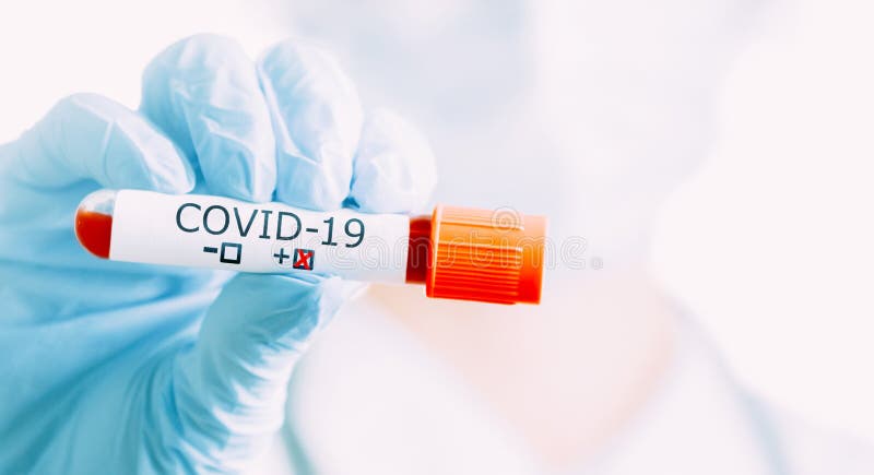具有阳性血液测试COVID-19的科学家持管 免版税图库摄影 具有阳性血液测试COVID-19的科学家持管 免版税图库摄影