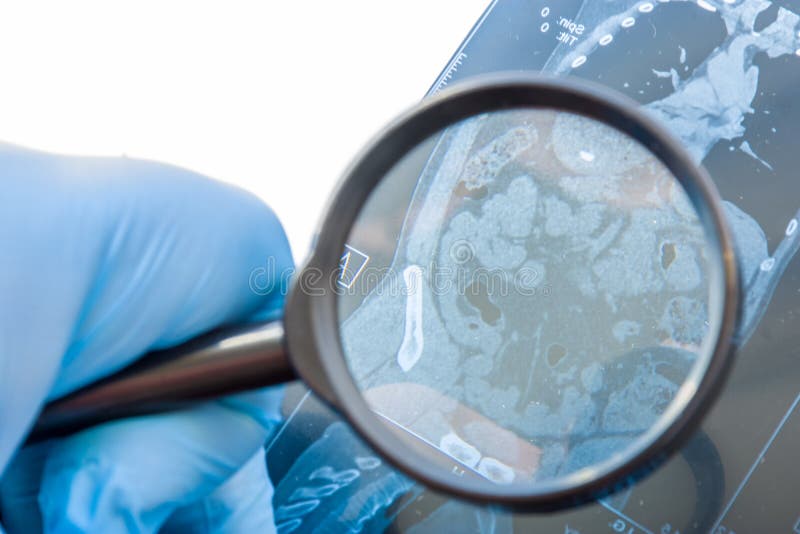 医生检查腹部器官的 MRI 快照，包括大肠和小肠。仔细诊断罕见且广泛存在于肠道 d 免版税库存照片