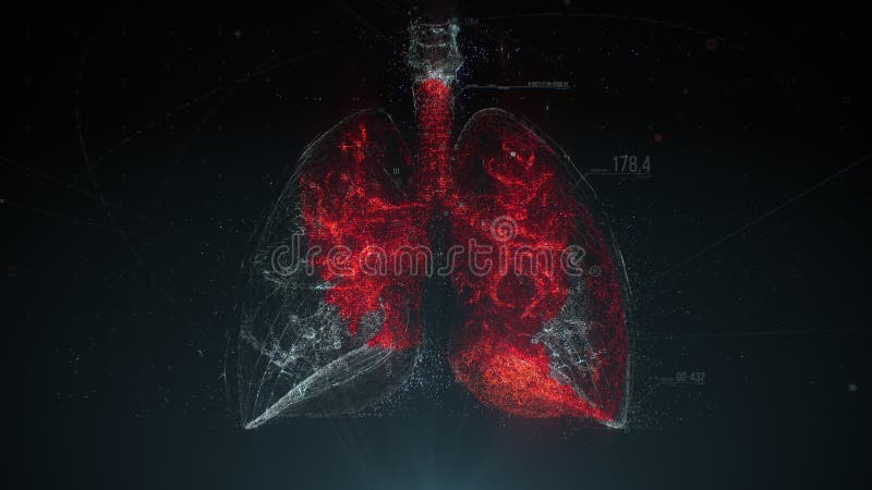 呼吸系统感染. 肺炎