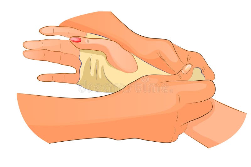 Vector illustration of a bandage in case of injury of wrist joint. Vector illustration of a bandage in case of injury of wrist joint