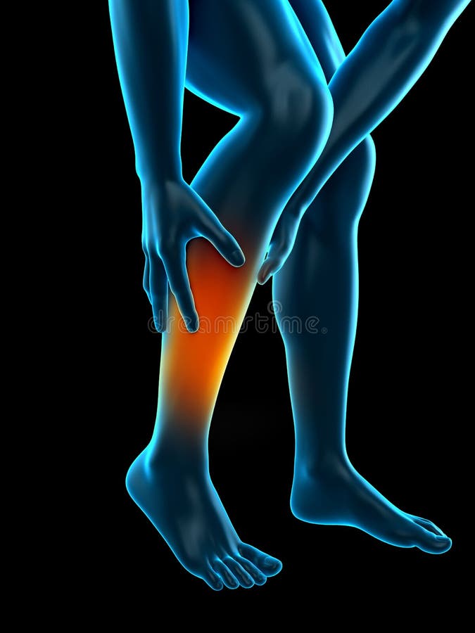 Medically accurate 3d illustration of calf pain. Medically accurate 3d illustration of calf pain