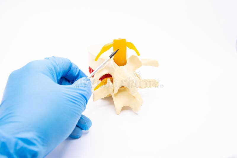 一位身穿蓝色手套和手术服的医生用指示器指向颈椎，讲解脊髓。用于演示文稿、广告等场合 库存照片