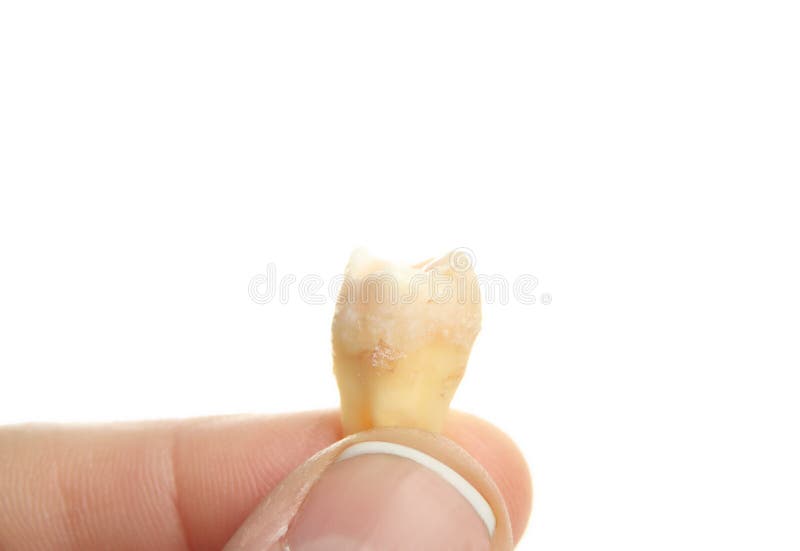 提取后手持智齿. 免版税库存照片