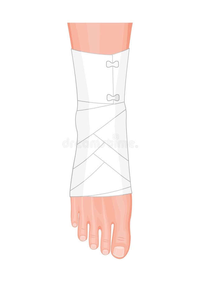 Illustration of Correct way to wrap an ankle by flexible elastic supportive orthopedic bandage sprain, strain. Illustration of Correct way to wrap an ankle by flexible elastic supportive orthopedic bandage sprain, strain.