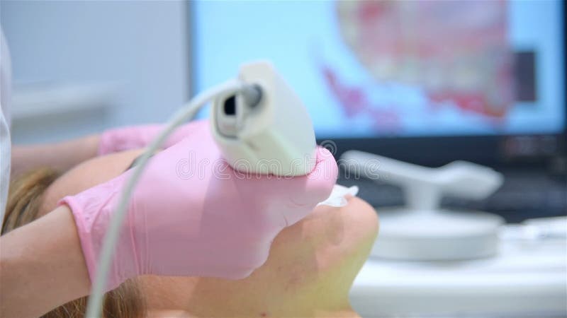 牙医3D扫描在临床牙诊中的应用.
