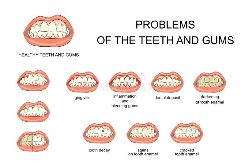 牙和胶的问题