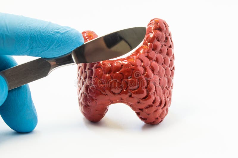 甲状腺手术 拖延在手套的手外科解剖刀的外科医生甲状腺容量模型 手术operat的概念 库存图片 甲状腺手术 拖延在手套的手外科解剖刀的外科医生甲状腺容量模型 手术operat的概念 库存图片