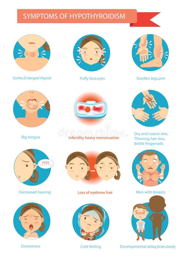 Symptoms of the disease Hypothyroidism illustrations in the circle.Cartoon Vector. Symptoms of the disease Hypothyroidism illustrations in the circle.Cartoon Vector