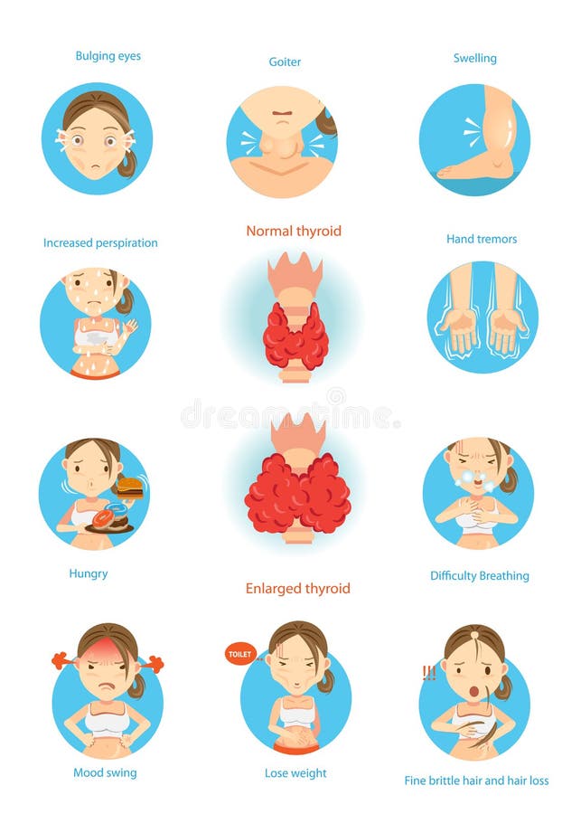 Symptoms of the disease hyperthyroidism illustrations in the circle. Cartoon Vector. Symptoms of the disease hyperthyroidism illustrations in the circle. Cartoon Vector