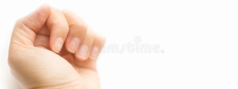 白色背景下做坏指甲后特写女指甲 表皮指甲和被污染的指甲板 免版税库存图片 白色背景下做坏指甲后特写女指甲 表皮指甲和被污染的指甲板 免版税库存图片