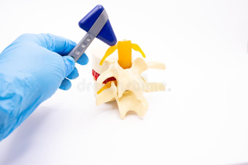 神经科医生或脊柱病专家用神经锤在手中触摸脊柱的人工模型 库存照片