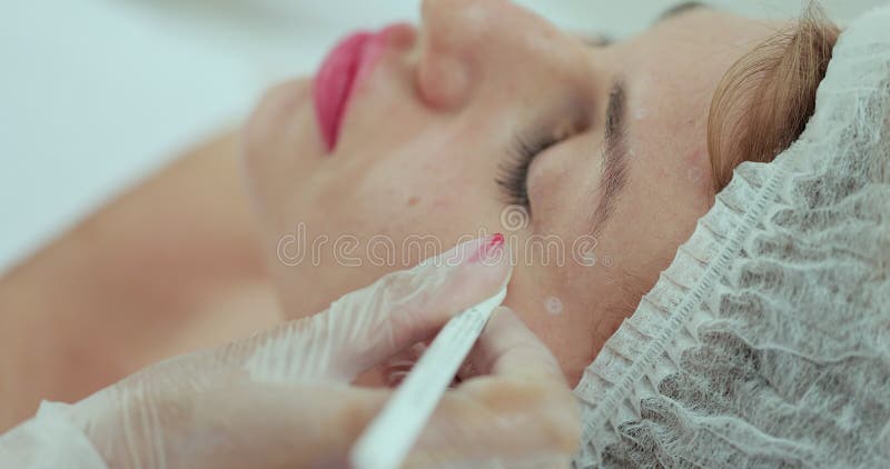 美容师用铅笔在女人脸上的注射点上标记. 美容.