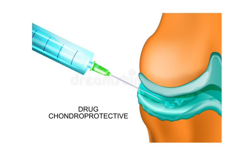 Vector illustration of an injectable treatment of joints. Vector illustration of an injectable treatment of joints