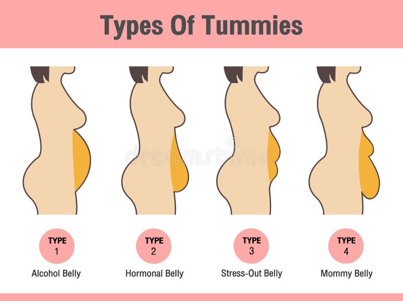 low cost tummy tuck near me low cost tummy tuck near me