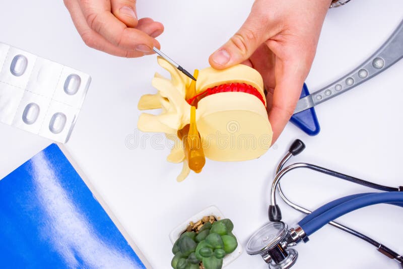 脊髓神经节病理作为背痛的原因。神经科医生或创伤科医生在会诊时向患者展示 免版税库存图片