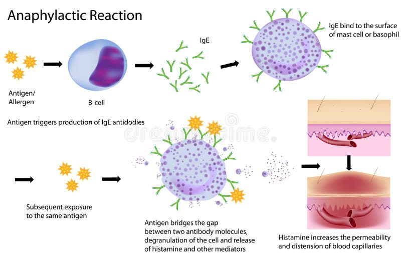 Diagram of the process of allergy response, eps8, gradient and mesh printing compatible. Diagram of the process of allergy response, eps8, gradient and mesh printing compatible