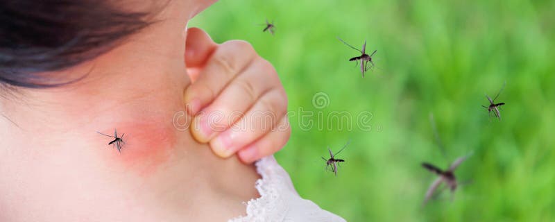 逗人喜爱的亚裔女婴有疹和过敏在脖子皮肤从蚊咬 库存照片